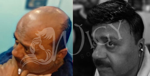 Hair Bonding Service